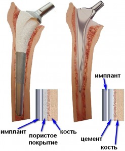 Рис.4